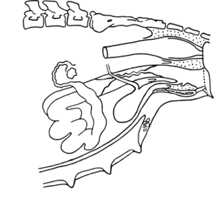 ファイル:ブタの雌性生殖器（側面）.svg